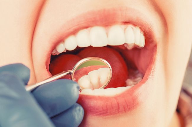 Oral Conscious Sedation In Sacramento, CA